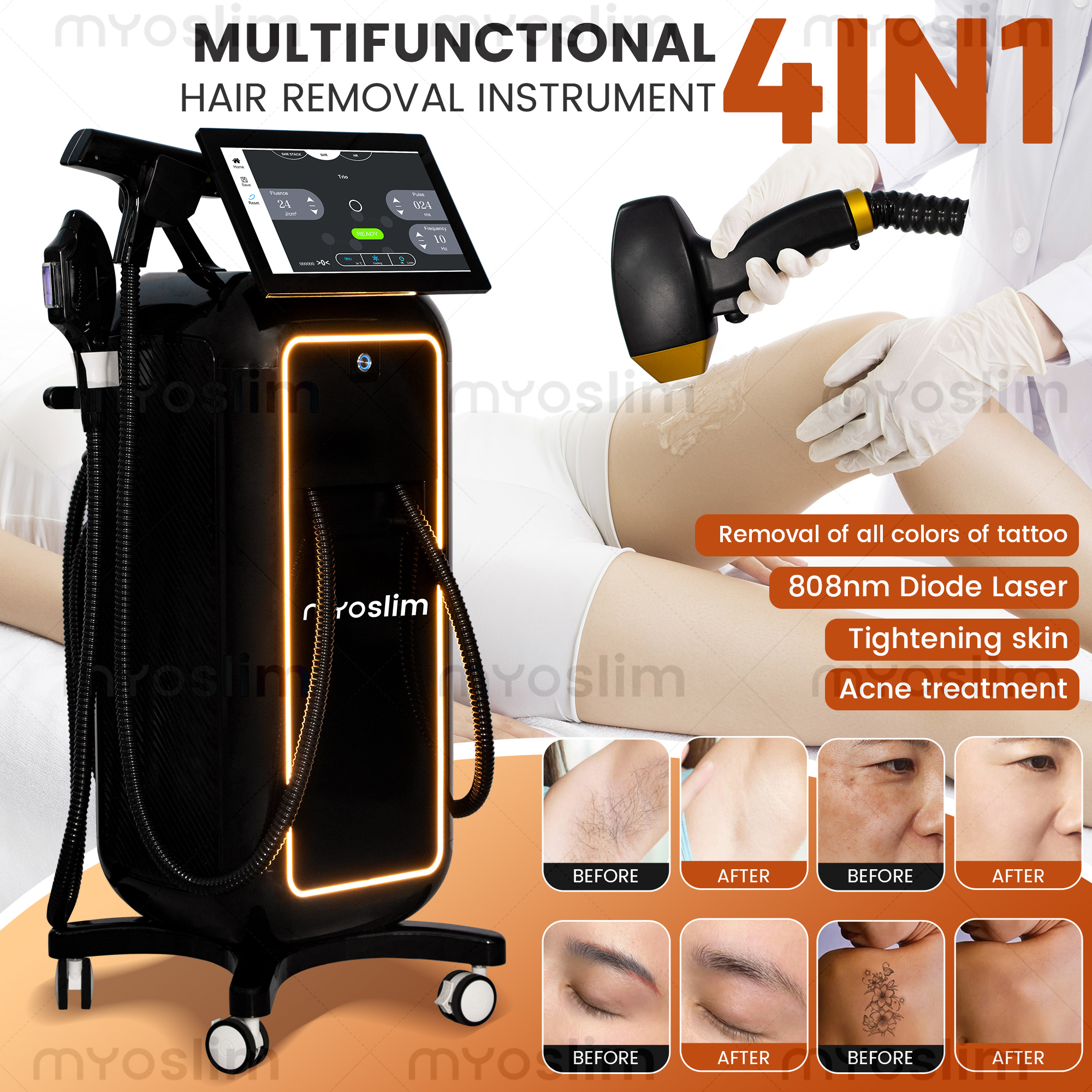 Soprano 4 in 1  Diode Laser Ha - огляд і ціна Industrial Laser Cleaning Machine