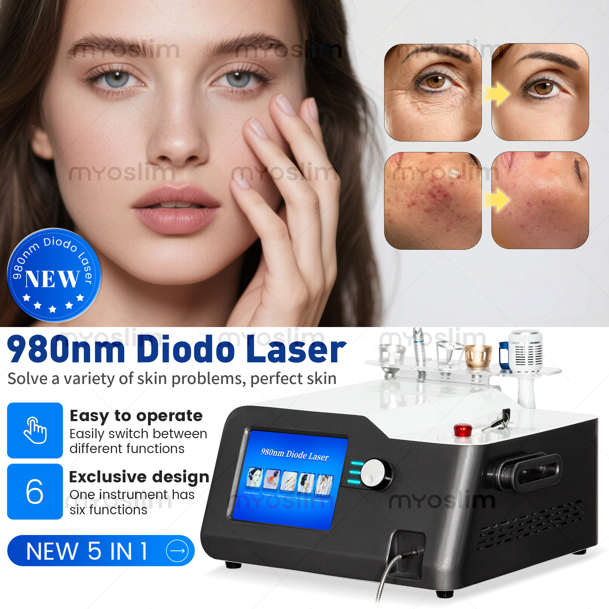 Portable 30W 5 in 1 980 nm Dio - огляд і ціна Industrial Laser Cleaning Machine